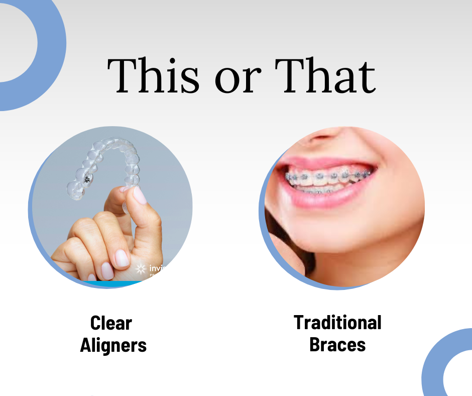 Clear Aligners VS Braces!