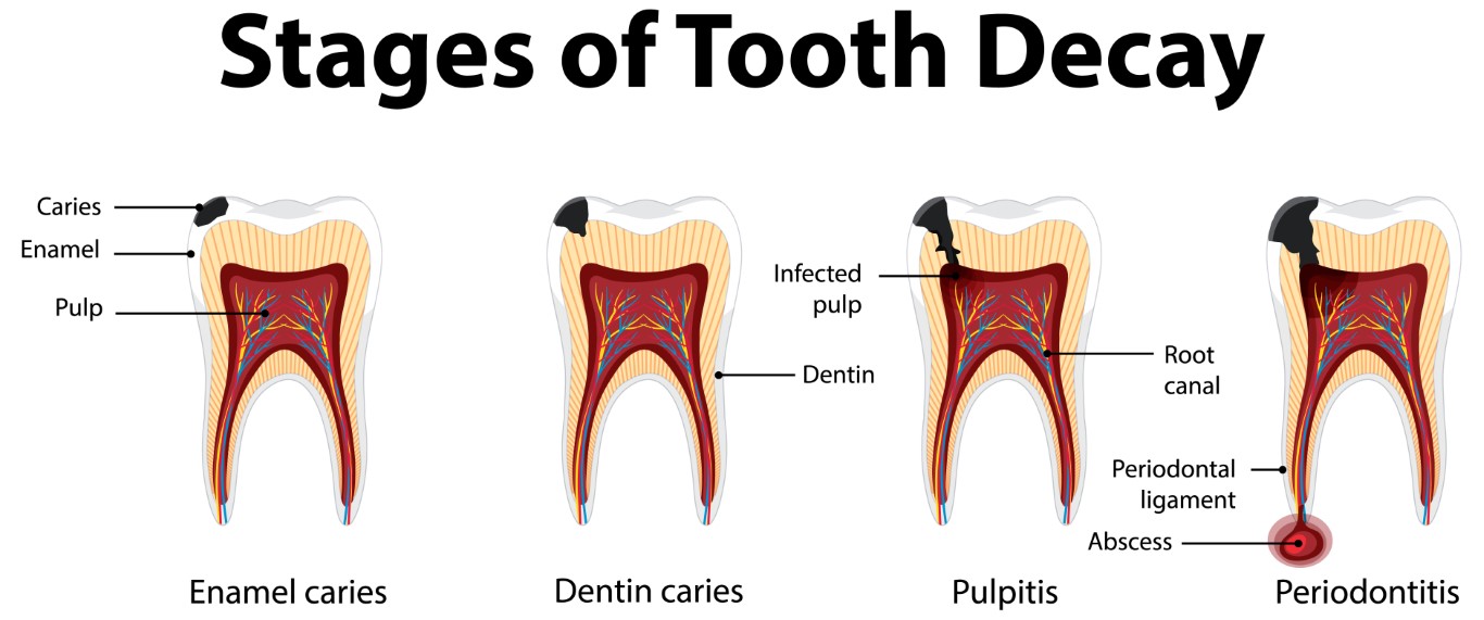 Why You Should Never Delay Dental Treatment