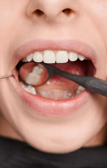 black mirror in mouth