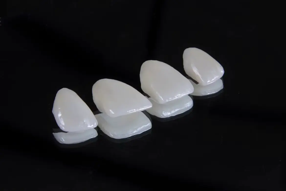 contract photo of dental veneers