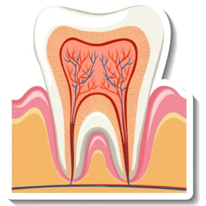 Tooth Nerve Pulpotomy Diagram